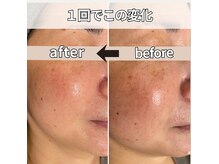 モーイエンチャーム(mooi en charme)