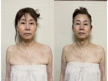 プルモア 蔵王店(PURU-MORE)/身体から整える、本気の小顔矯正