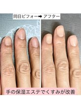 桃の木 吉祥寺店/乾燥に負けない潤う手