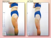 ジュリア オージェ 梅田店/ビフォーアフター（脂肪燃焼）