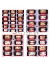 ルブラン 奈良店(Le Blanc)/皆様！白い歯に！