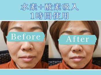 ヨサパーク ラ エトワール 広畑店(YOSAPARK)/お客様の変化