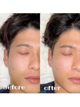 ランド(LAND)/【メンズ】HBL＋眉wax