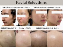 エメ(aimer)の雰囲気（小顔｜リフトアップ｜脂肪分解｜毛穴改善｜ニキビケア｜肌管理｜）