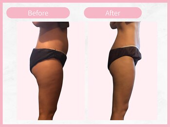 アールエイチビー 藤沢店(RHB)/