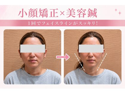 アンブル(Ambre)の写真