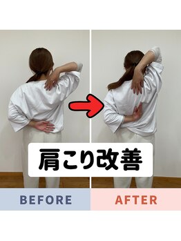 Nストレッチの写真/【何をしても楽にならない肩こり。原因から見直しませんか？】肩こり根本改善ストレッチで悩まない身体へ！