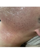 テンパ ビューティー(+10%beauty)/効果写真