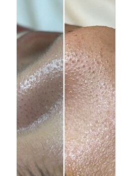 アリー(Arie)/Face Wax（鼻）