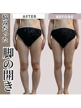 オルオル(.olu olu)/脚の開きでお悩みの方