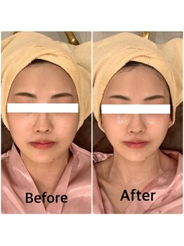 スペチアーレ 夙川/小顔と美肌で美顔革命♪