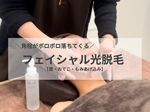 リモア(REMORE)/顔脱毛でみるみる美肌に