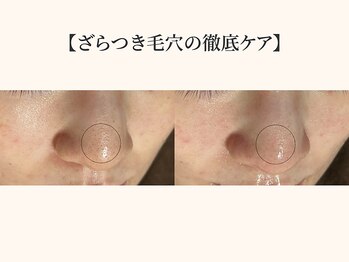 ドリームスパ 町田店(DREAM SPA)/before→after