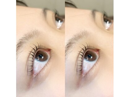 ダブリューアイキャンディー(W eye candy)の写真