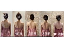 ロココ 豊田店(Rococo)/ビフォーアフター