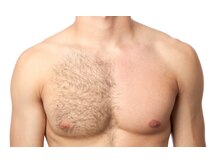 キナリ(kinari)/胸ワックス脱毛