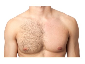 キナリ(kinari)/胸ワックス脱毛