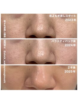 リレフー(Relafy)/★美肌★32歳 女性 2年