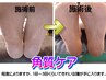 つるつる踵☆角質ケア無料キャンペーン☆