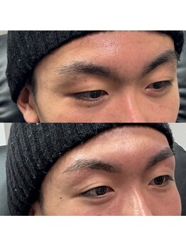 ブリス 姫路(Bliss)/お客様Before/After