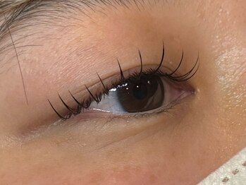 アポロランド ルーナ/リフエク100本