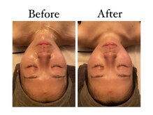 クレビア 麻布十番(CREBIA)/スッキリ小顔♪