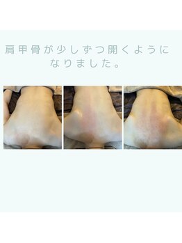 ソワンドメイ 四谷(SOIN DE MEI)/肩凝り改善、肩甲骨開き