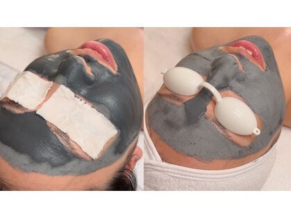 ハルスキン 自由が丘(HARU SKIN)の写真