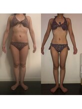 レナトゥス 銀座(Renatus)/BeforeAfter【痩身/東京/銀座】