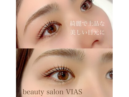 ビアス(VIAS)の写真