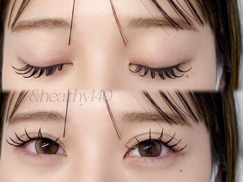 ライラ(LAYLA)/アンドヘルシー140本