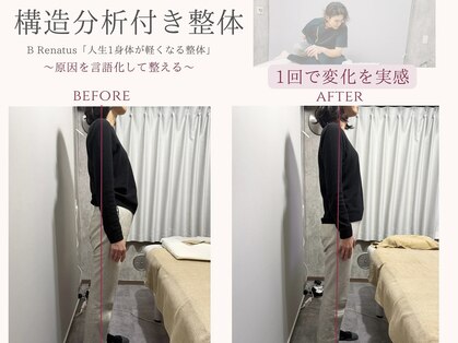 ビーレナトゥス(B Renatus)の写真