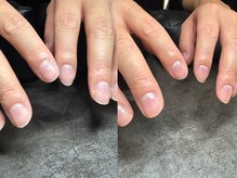 アンノウン 梅田店(Unknown.)/メンズネイルケア