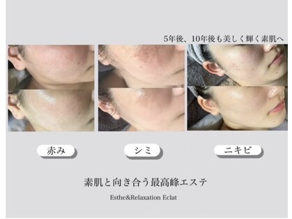 エステアンドリラクゼーション エクラ(Eclat)の写真