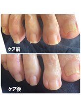 ユキネイル(YUKINAIL)/フットケア初心者さんに