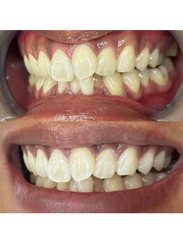 ライトビューティー 池袋店(LightBeauty)/症例写真