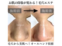 アンプールビューティー(Ampul Beauty)