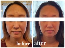 フェイス 本店 盛岡岩手(FACE)/