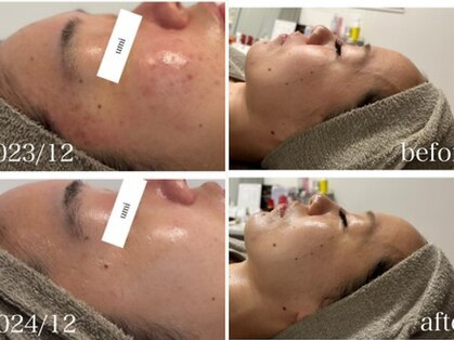 ウミ(umi)の写真