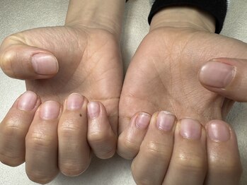 リンク(LINK)/クリアネイル