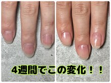 ウイ(Oui)の雰囲気（誰にもバレずに自爪育成/深爪育成◆爪の悩み解決！）