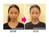 【骨格エステ/小顔矯正お試し】写真付き/頭蓋骨/顎関節対応(30分)￥13,200→