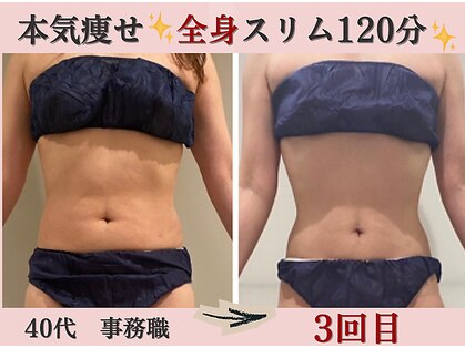 マール(Mar)の写真