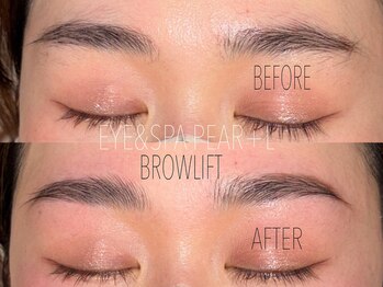 パール(PEAR+L)/ハリウッドブロウリフト