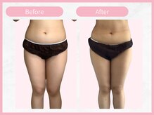 アールエイチビー 藤沢店(RHB)/