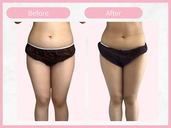 アールエイチビー 藤沢店(RHB)/