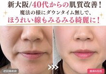 スリーピングビューティー(Sleeping Beauty)
