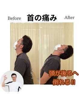 三条かがやき整体院/首の痛み改善