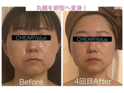 チェアリープラス(CHEARYplus)の写真