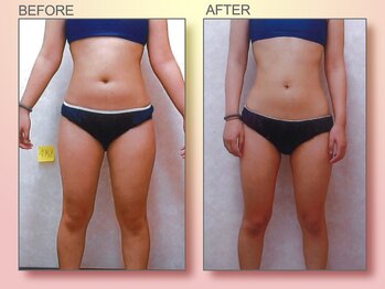 ジュリア オージェ 梅田店/ビフォーアフター(エンダ)